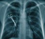 Violent Doctor-Patient Cases: What’s Wrong with China’s Healthcare System?