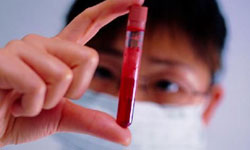 104 People are Diagnosed with Cancer Everyday in Beijing