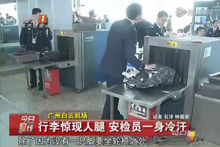 Man Caught Carrying Own Severed Leg Through Guangzhou Customs