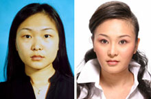 Going Under the Knife: Artificial Beauty in Beijing