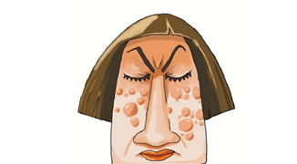 Acne Sufferer Eliminated from Civil Servants Exam for Being “Too Ugly”