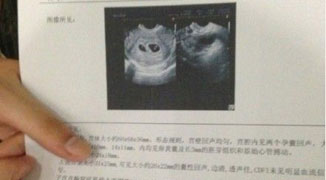 19 Year-Old University Student Under Fire for Posting Photos of Abortion Online 