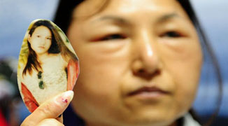 28 Year-Old Gansu Woman’s Face Dramatically Ages After Plastic Surgery Failure