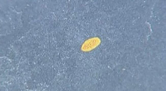 Shanghai Residents Speculate Over Cause of Flying Feces