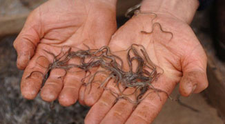 Eels Enters Man’s Body Via Reproductive Organs, Extracted from His Kidney