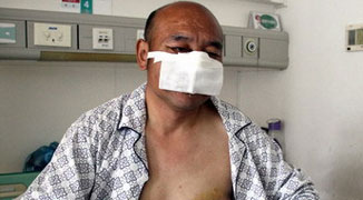 Xinjiang Awesome Badass Fights off Bear with Rock