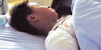 Boy Loses Arm to Bear in Zoo