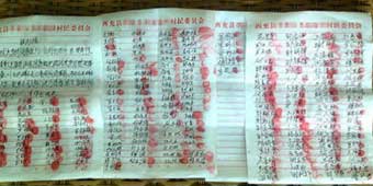 Villagers Demand Eight Year Old HIV Patient Leaves over Safety Concerns